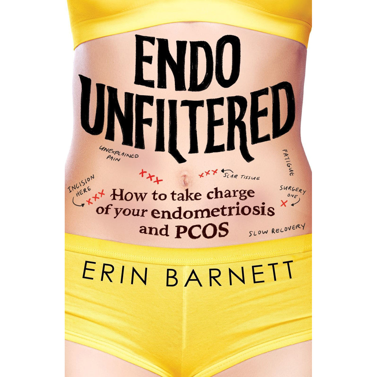 Endo Unfiltered: Honest Endometriosis Memoir